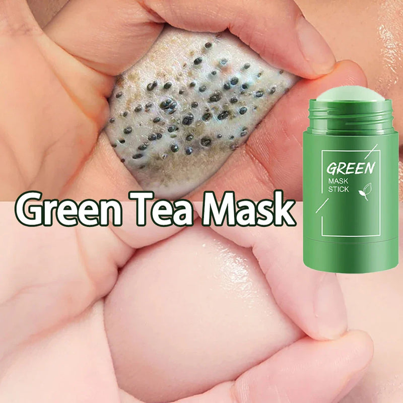 Original Green Tea Facial Blackhead Remover – Solid Mask for Acne, Blemishes, and Pore Shrinking Skin Care