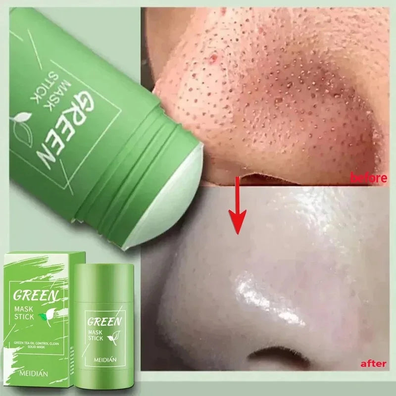 Original Green Tea Facial Blackhead Remover – Solid Mask for Acne, Blemishes, and Pore Shrinking Skin Care